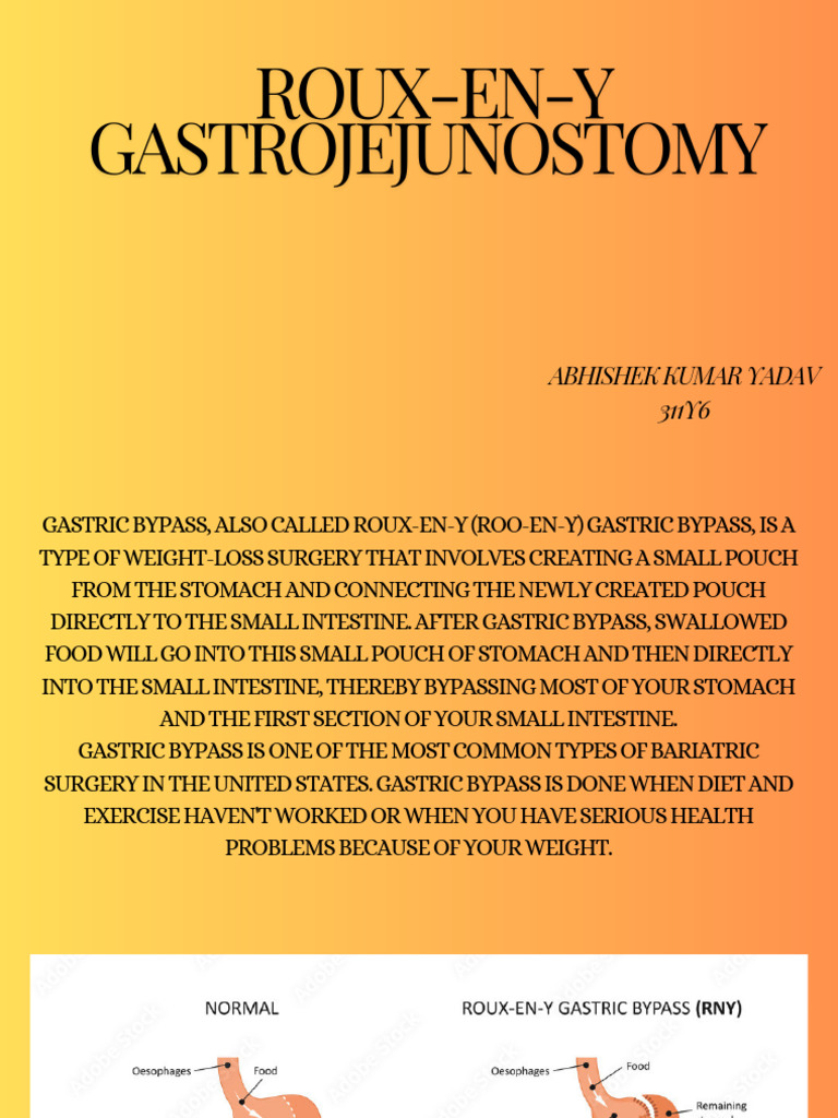 Roux-en-Y Gastroje 3 | PDF