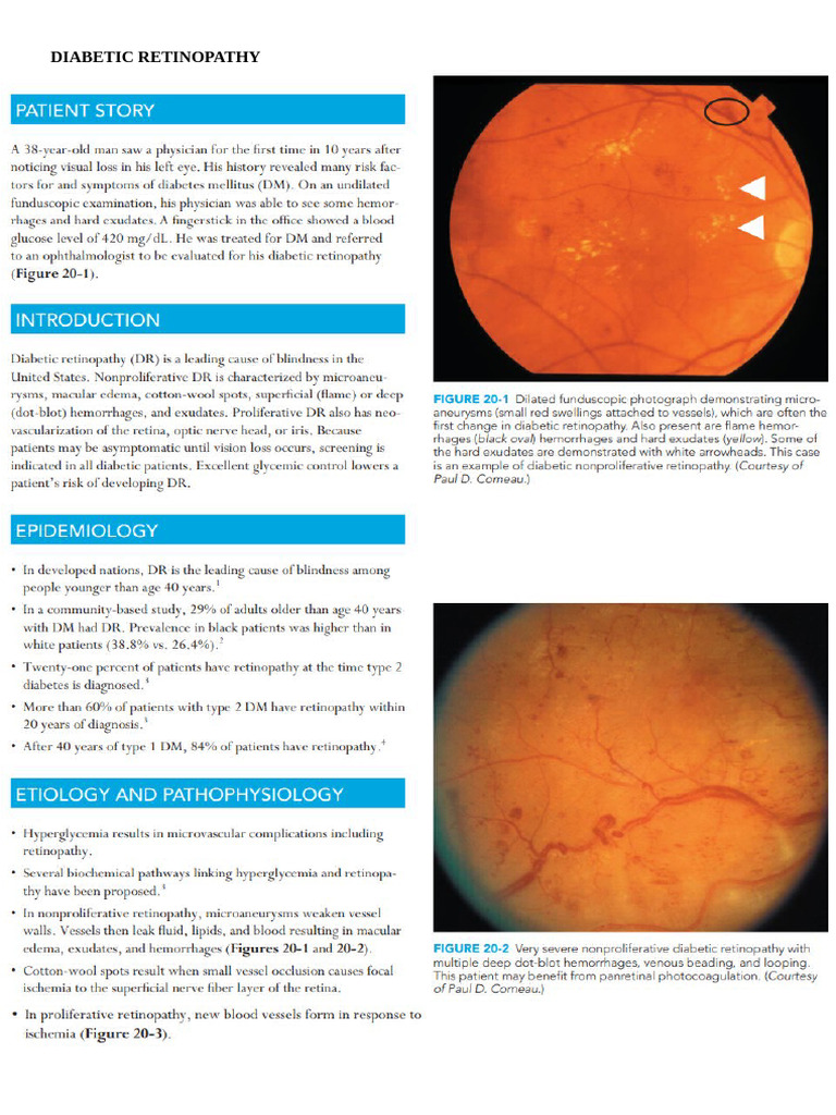 Diabetic Retinopathy | PDF
