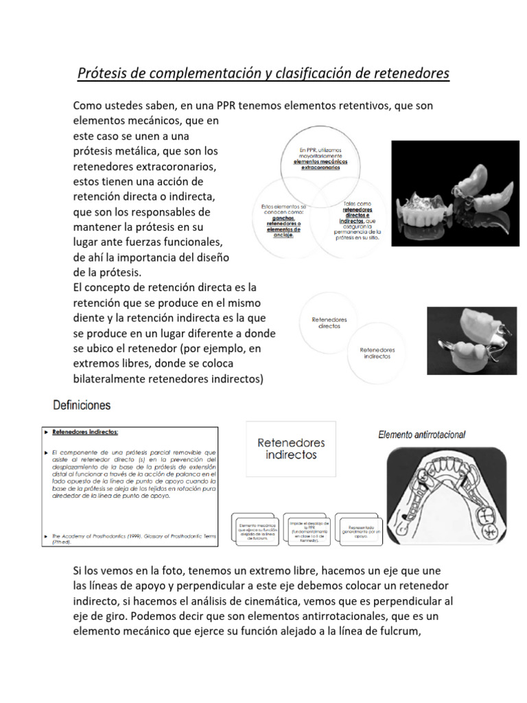 Prótesis de Complementación y Clasificación de Retenedores | PDF