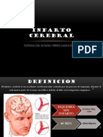 Infarto Cerebral