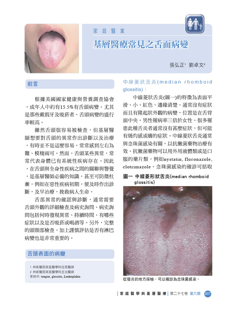 圖一 中線菱形狀舌炎 (median rhomboid glossitis) | PDF