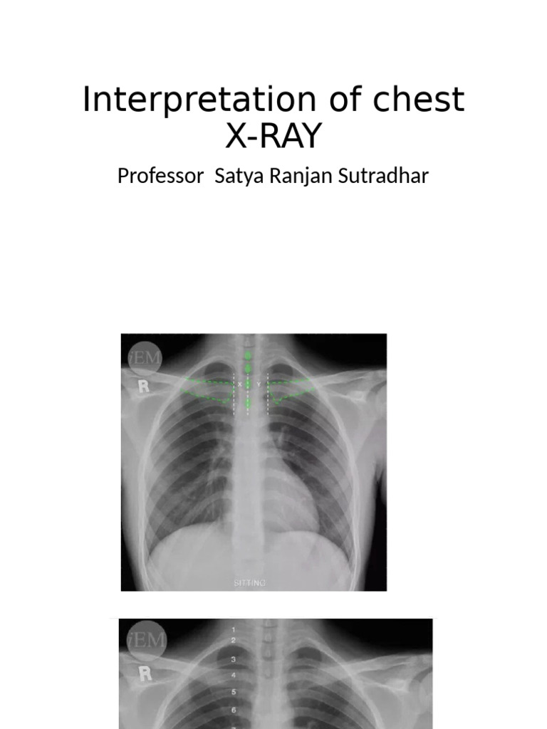 x Ray Interpretation PDF Human Diseases And Disorders Respiratory