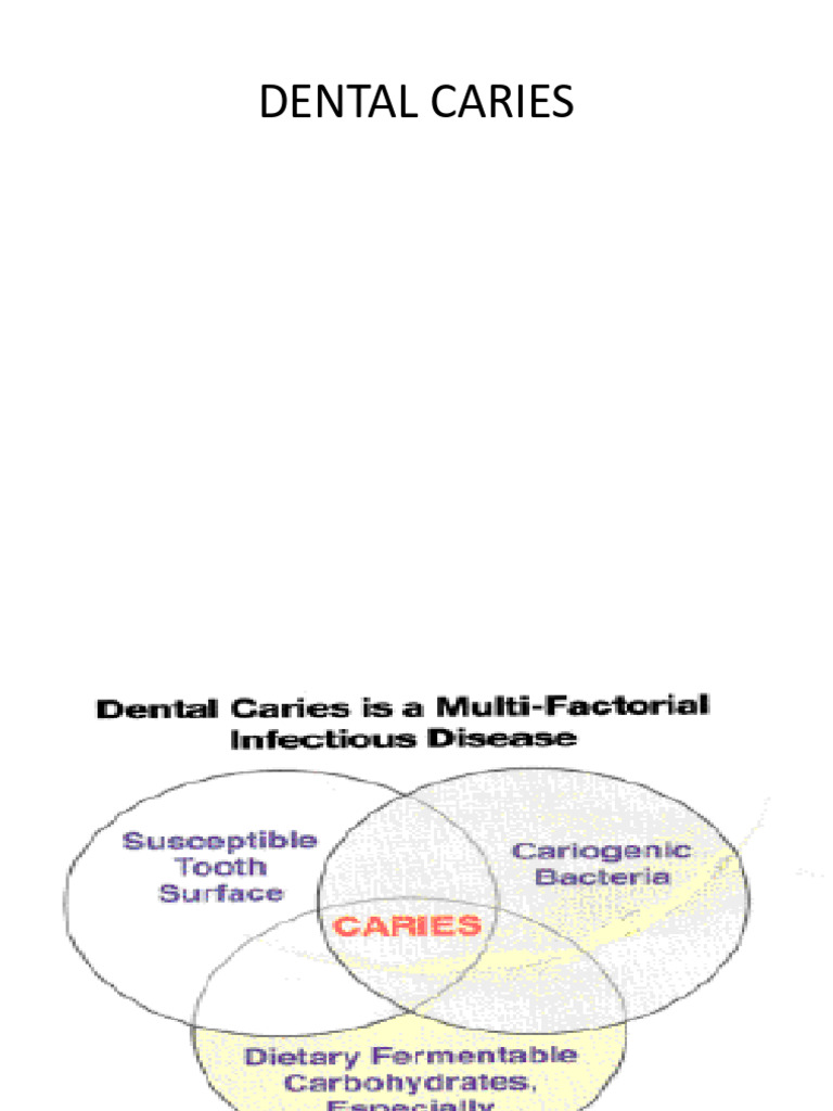 Dental Caries: Diagnosis and Management | PDF | Laser | Human Tooth