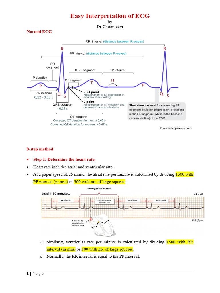 Easy Interpretaion of ECG - Year 2 DR Chiranjeeevi | PDF ...