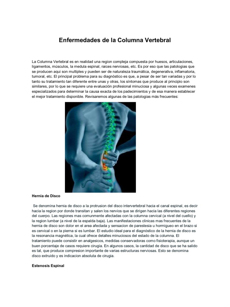 Principales enfermedades de la columna vertebral | PDF | La columna ...