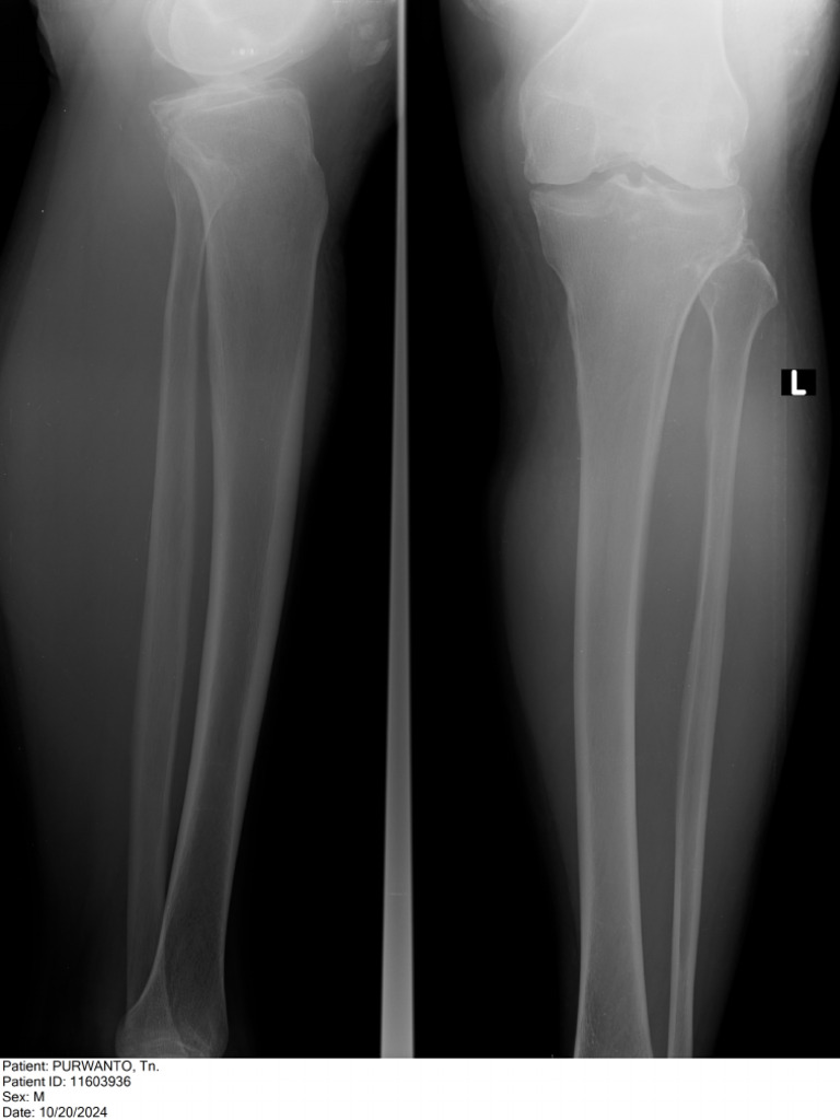 Rontgen Radius Ulna | PDF