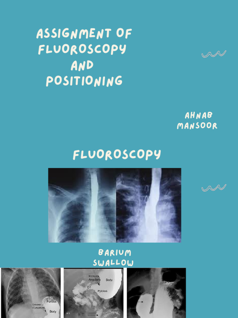 Fluoroscopy visual data 2