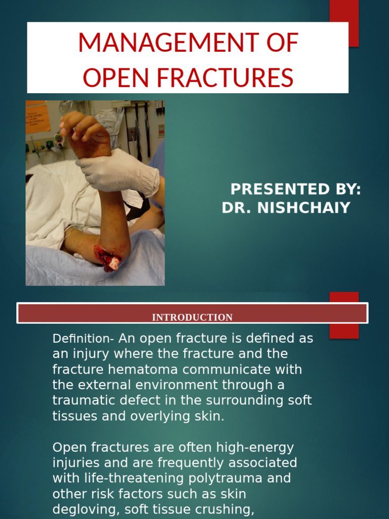 Management of Open Fractures Final | PDF | Wound | Amputation