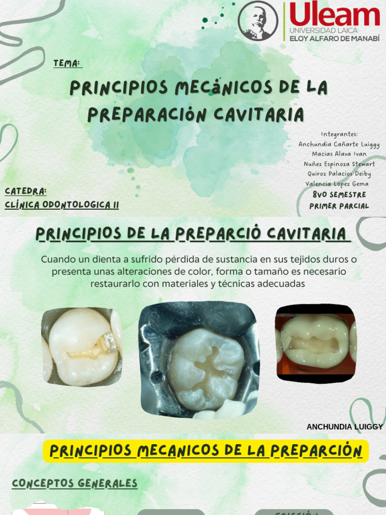 principios-mec-nicos-en-preparaci-n-cavitaria-pdf-viga-estructura