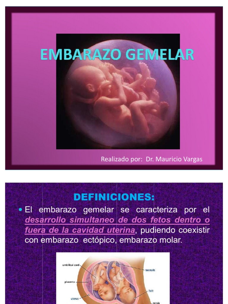 Embarazo Gemelar | Parto | Placenta