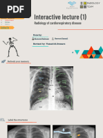 ABCDE Approach to Chest X-Ray Interpretation | PDF | Lung | Thorax