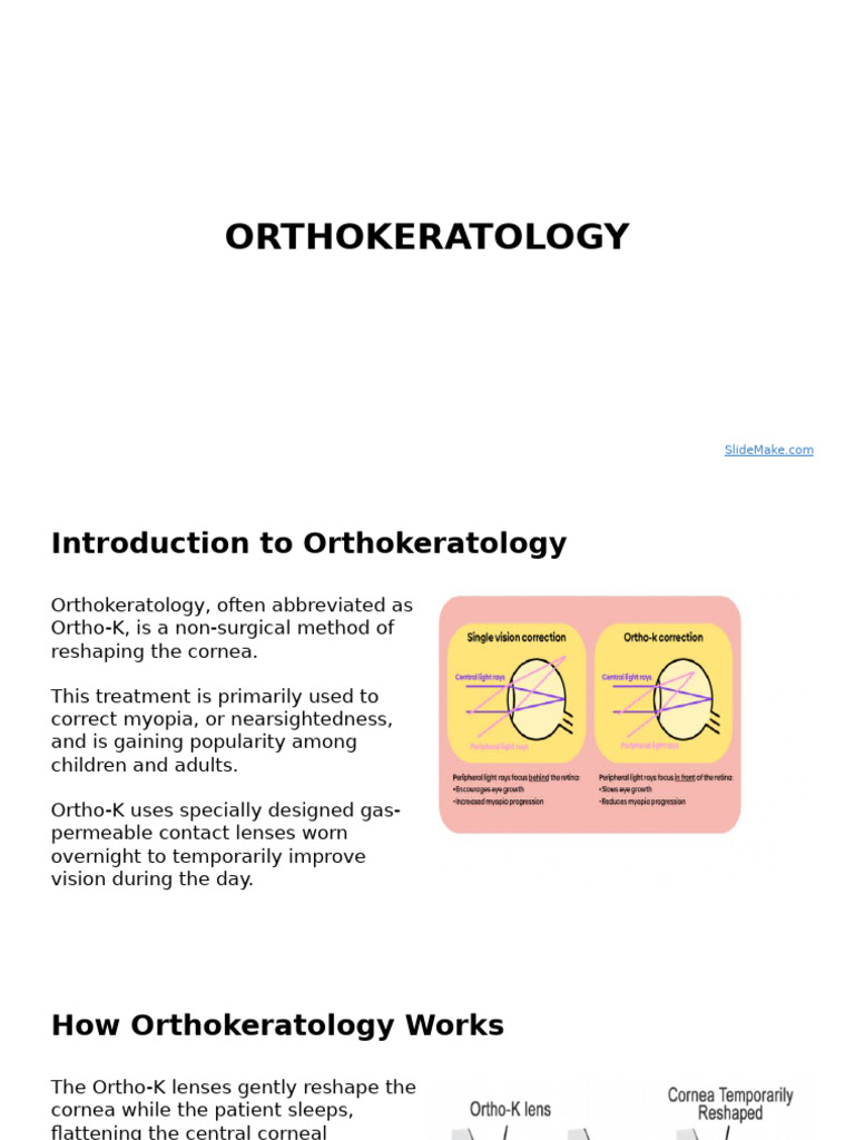 Overview of Orthokeratology Benefits | PDF | Myopia | Contact Lens