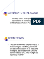 Sufrimiento Fetal Agudo (SFA)