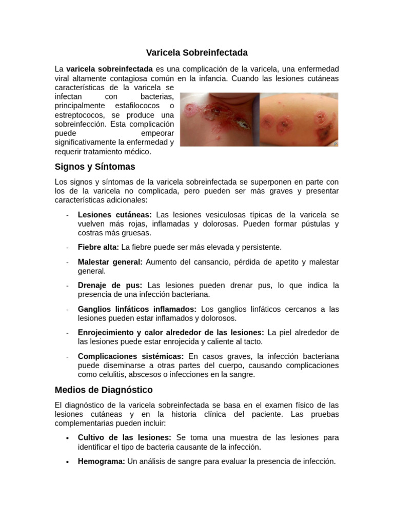 Varicela Sobreinfectada: Síntomas y Tratamiento | PDF | Causas de la ...