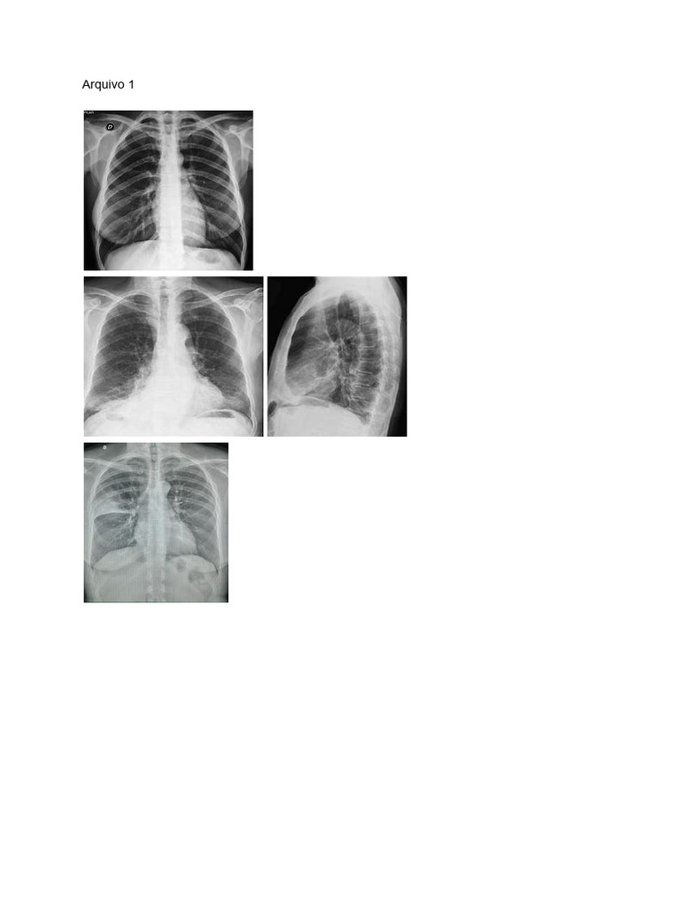 arquivo-imagens-de-rx5-pdf
