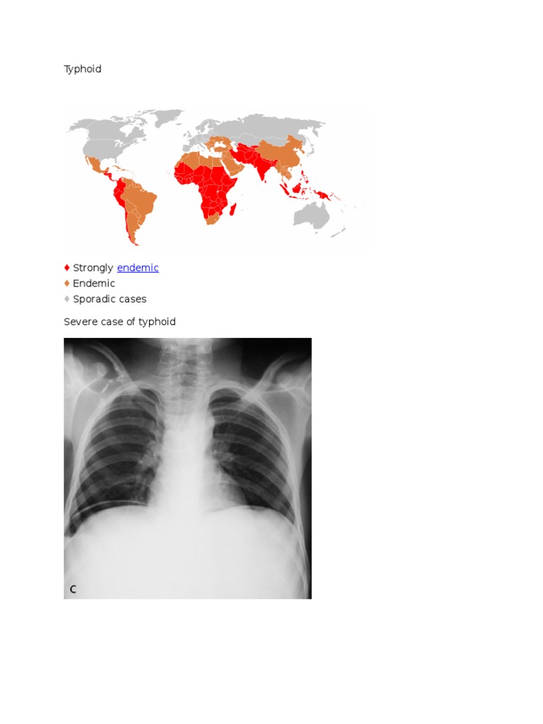 Understanding Typhoid Endemicity | PDF