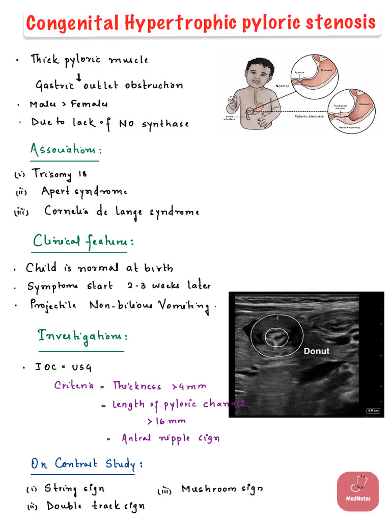 congenital-hypertrophic-pyloric-stenosis-pdf-digestive-system
