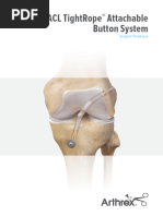 Endobutton™ CL Ultra: Fixation Device | PDF | Fixation (Histology ...