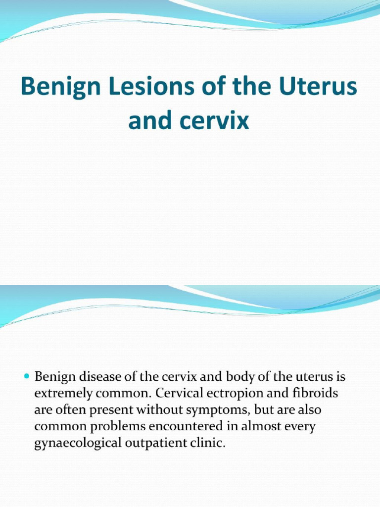 Benign Lesions of Cervix and Uterus | PDF