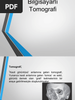 Spheno Occipital | PDF