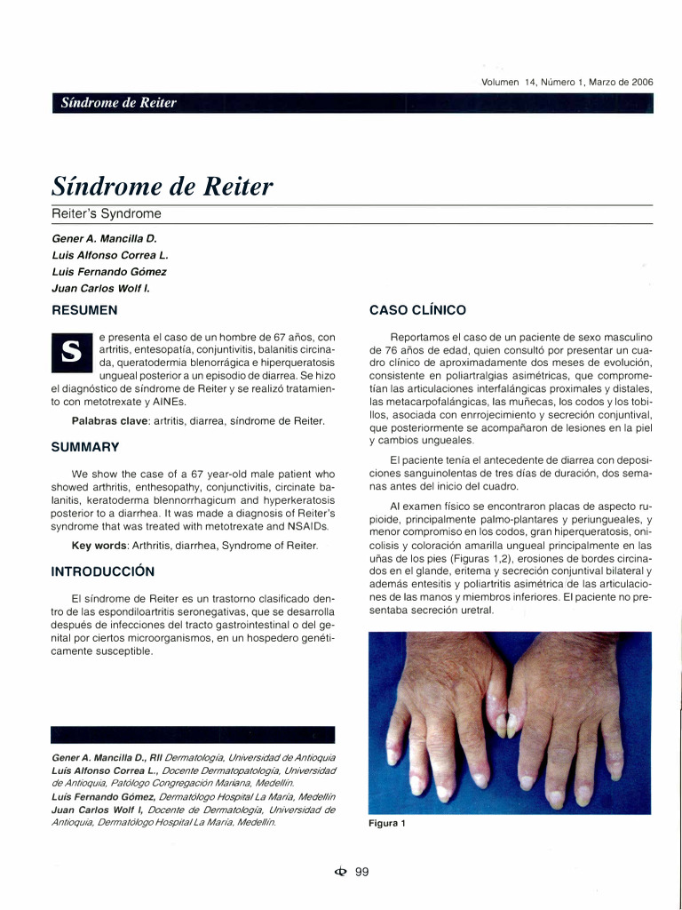 Síndrome de Reiter: síntomas y diagnóstico | PDF | Enfermedades y ...