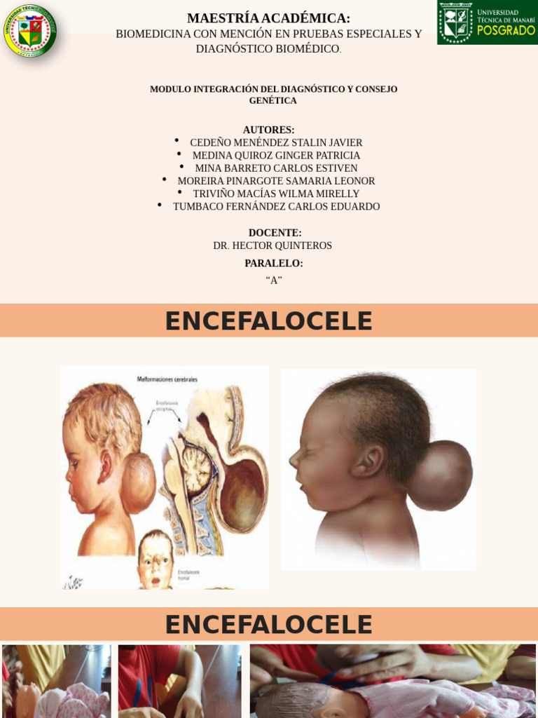 Encefalocele: Causas y Diagnóstico | PDF | Enfermedades y trastornos ...