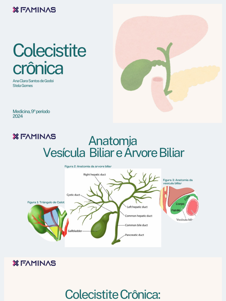 Colecistite Crônica: Definição e Tratamento | PDF | Bile | Doenças e ...