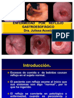 ERGE y ESOFAGITIS 2