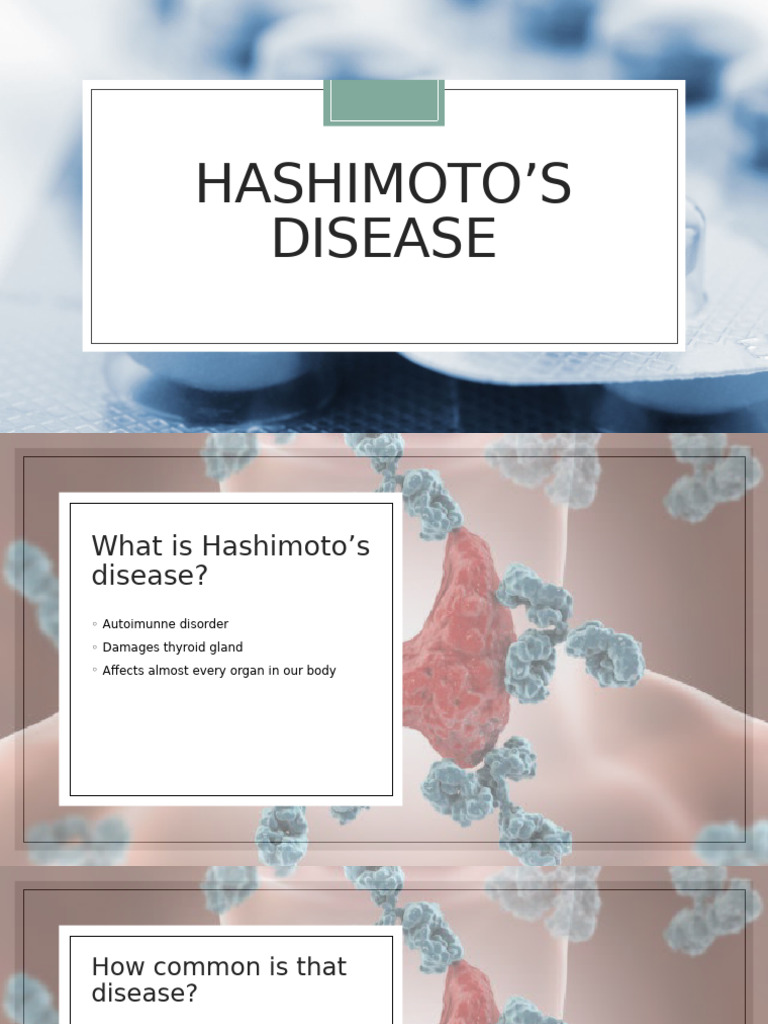Understanding Hashimoto's Disease Symptoms | PDF