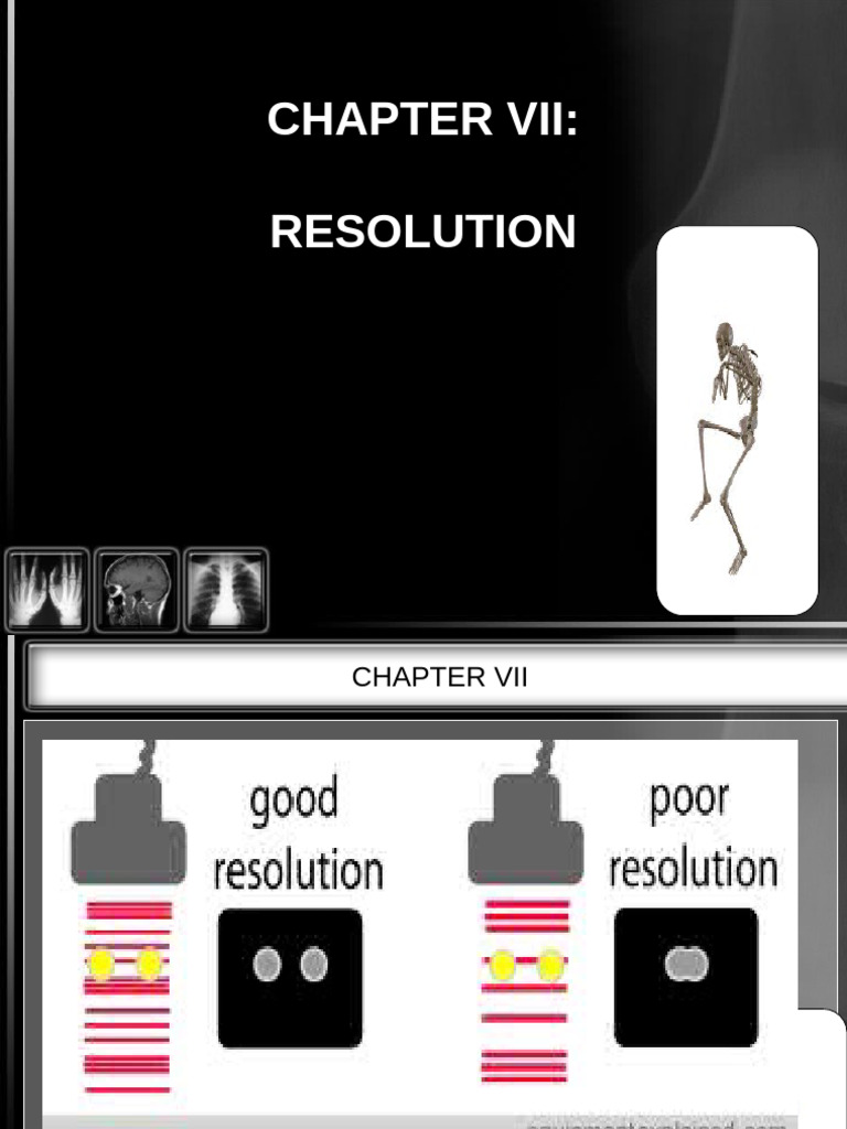 Understanding Imaging System Resolution | PDF | Angular Resolution ...