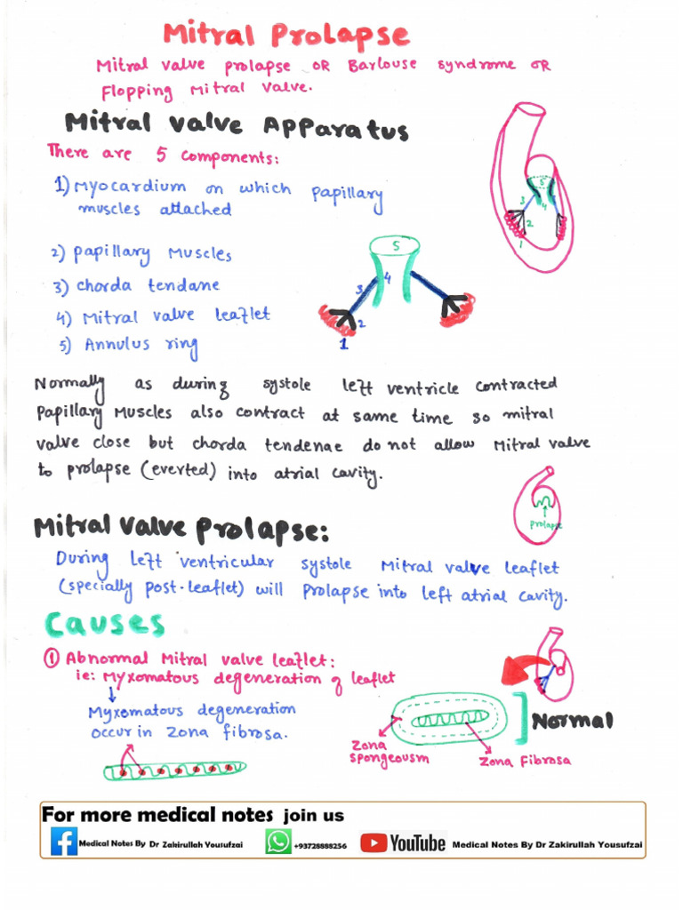 Mitral Prolapse & Regurgitation by DR Zakirullah Yousufzai 2 | PDF