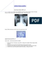 Pulmonary Tuberculosis Smear