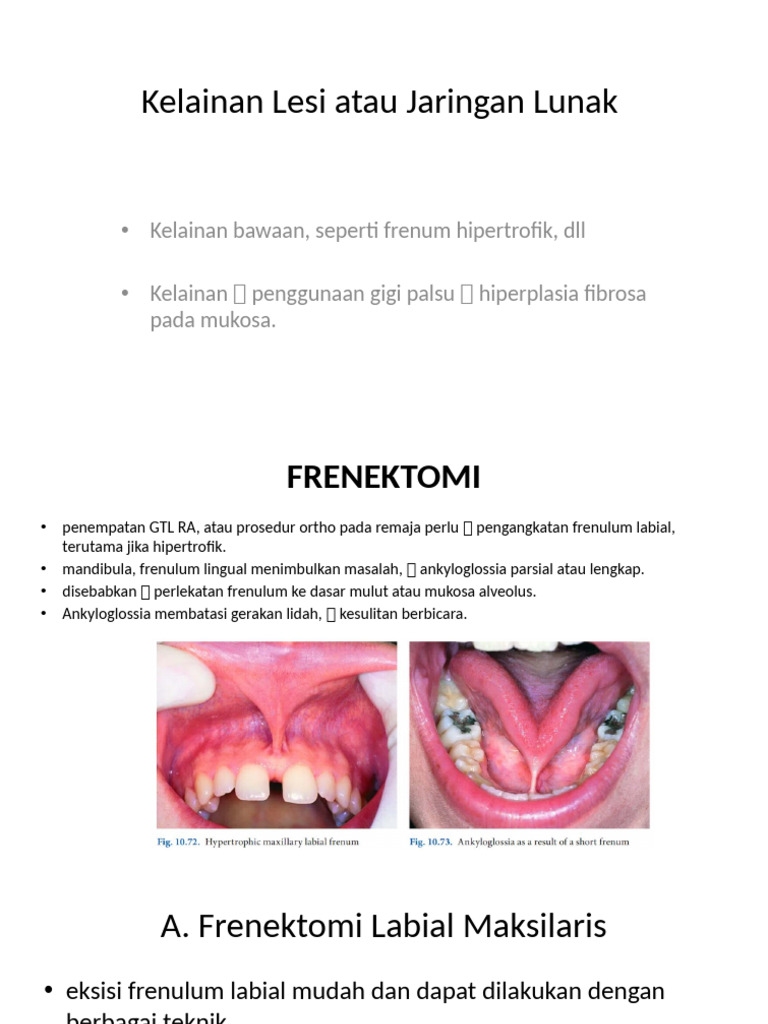 Soft Tissue | PDF