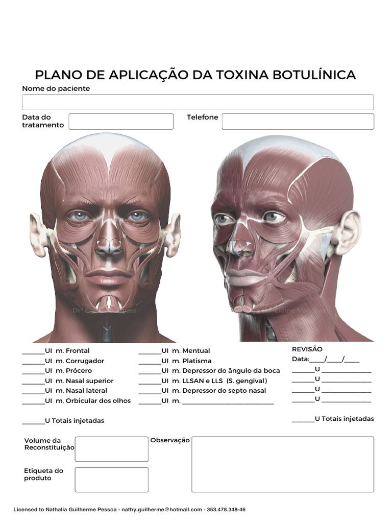 Abrir Plano de aplicação toxina botulínica | PDF