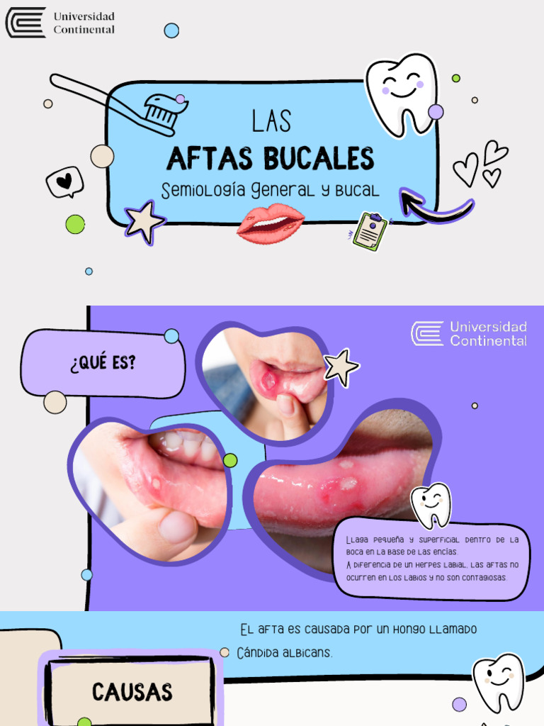 Las Aftas Bucales-Semiología General | PDF | Salud y bienestar ...