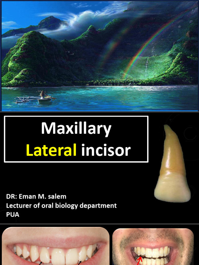 Lect 4 Max Lateral Lect - PDF DR Eman Salem | PDF | Tooth | Dental Anatomy