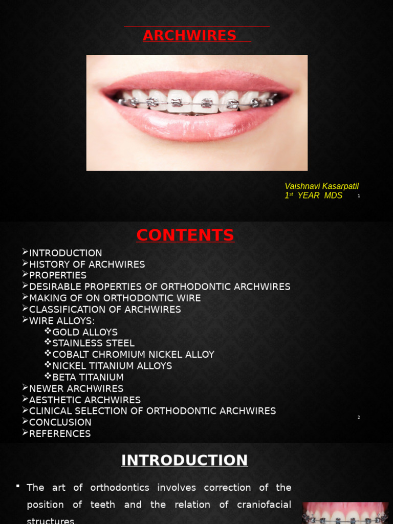 Orthodontic Archwires: Properties & Types | PDF | Deformation ...