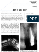 Implants in Children - A Case Report