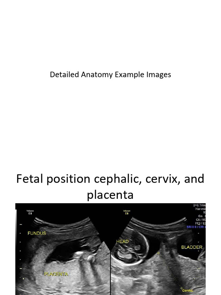 aium-2nd-tri-morphology-atlas-pdf