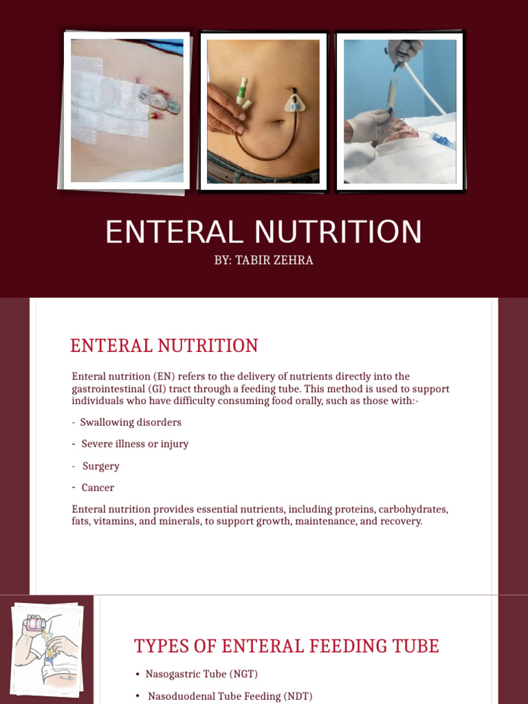 Enteral Nutrition: Feeding Methods & Plans | PDF | Calorie | Nutrition