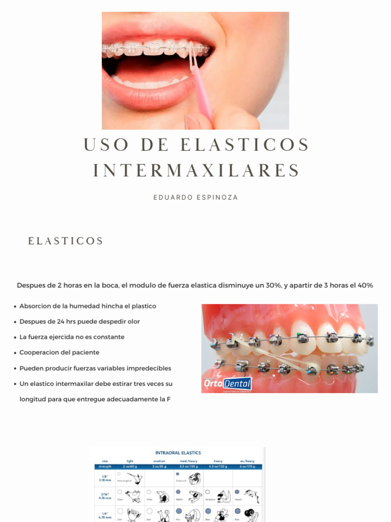 Guía de Elásticos Intermaxilares | PDF