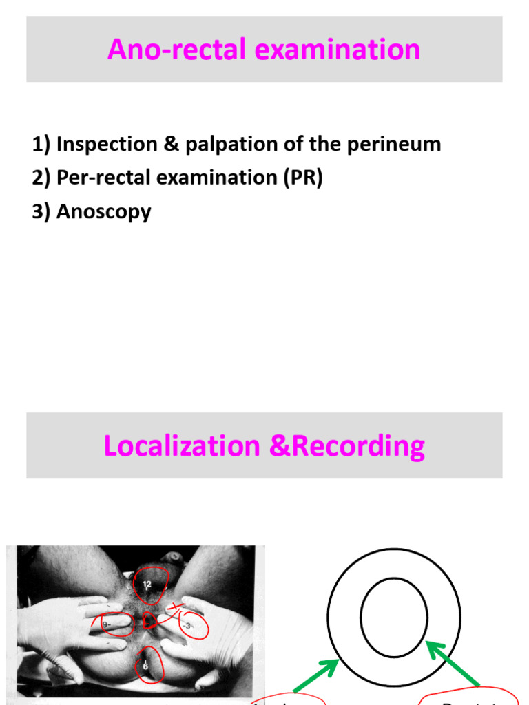 CommonAnorectal Disease14 | PDF | Hemorrhoid | Pelvis