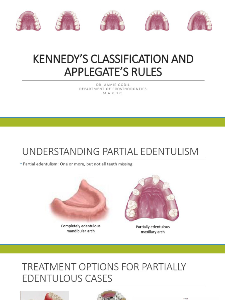Kennedy Classification Overview and Rules | PDF | Dentures | Dentistry ...