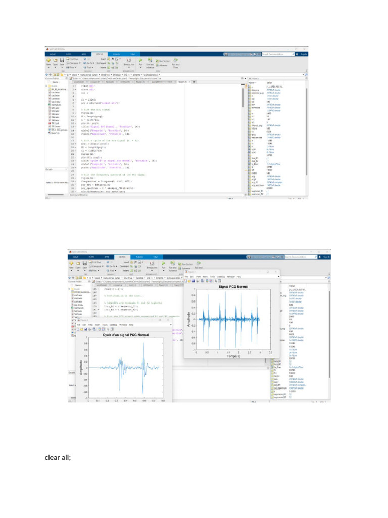 PCG Signal Analysis and Envelope Detection | PDF
