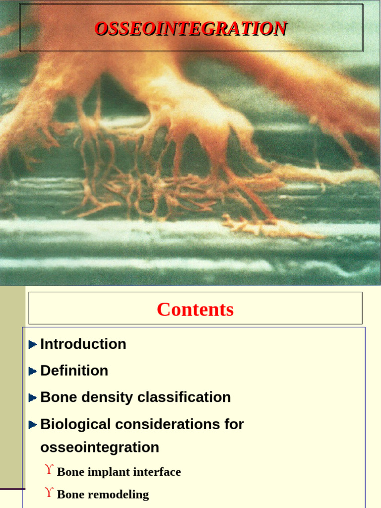 Understanding Osseointegration in Implants | PDF | Dental Implant | Bone