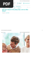 Plagiocephaly Severity Assessment Guide | PDF | Public Services ...