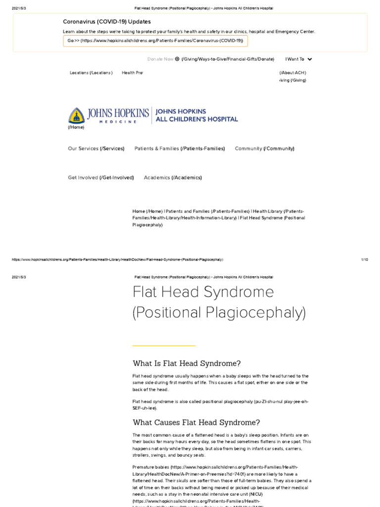 Flat head syndrome positional plagiocephaly johns hopkins all