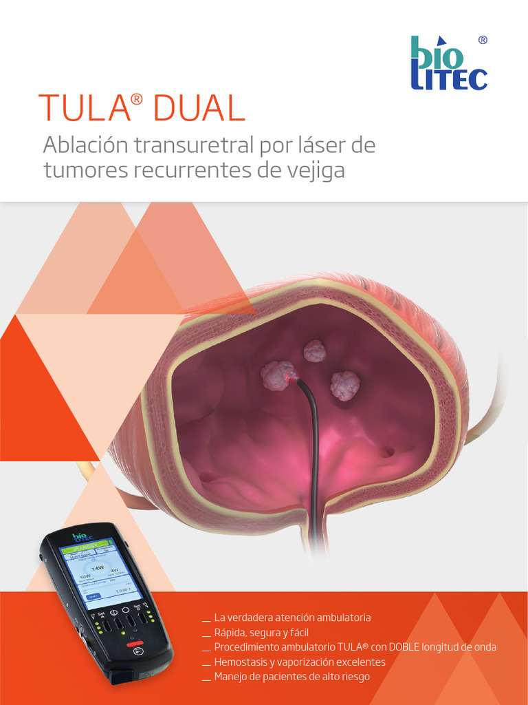 Ablación láser TULA® para cáncer de vejiga | PDF | Medicina CLINICA ...