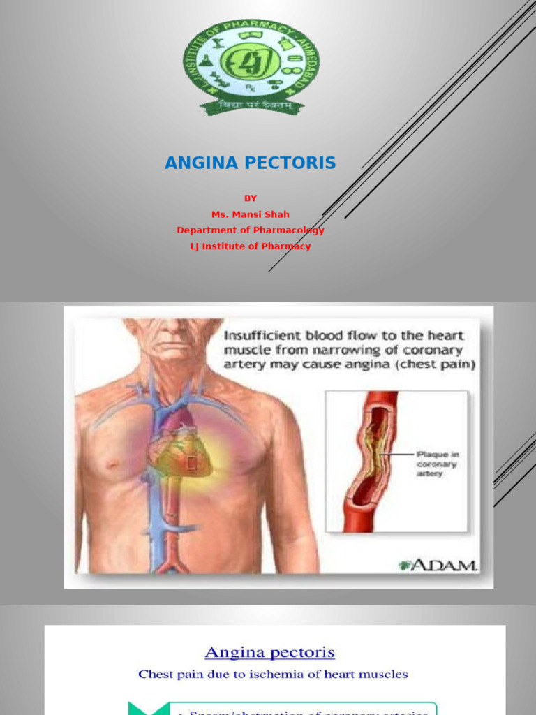 Understanding Angina Pectoris: Signs, Types, and Pathophysiology | PDF ...
