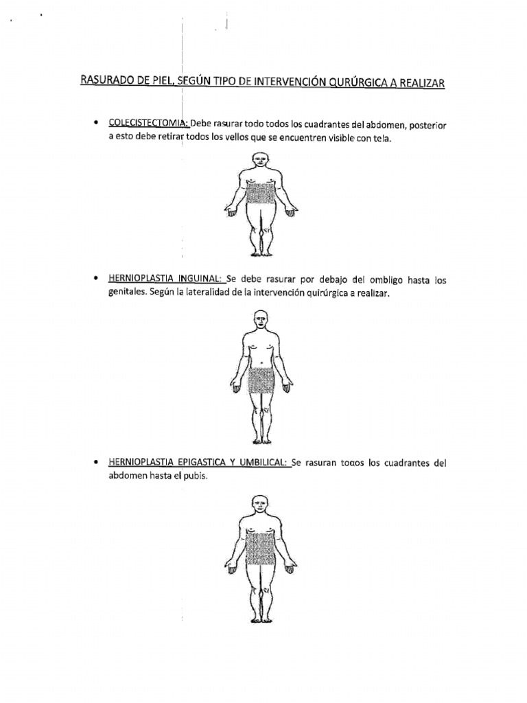 RASURADO de LA PIEL para Pacientes Prequirurgicos | PDF